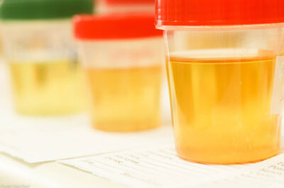 Specimen sample cups