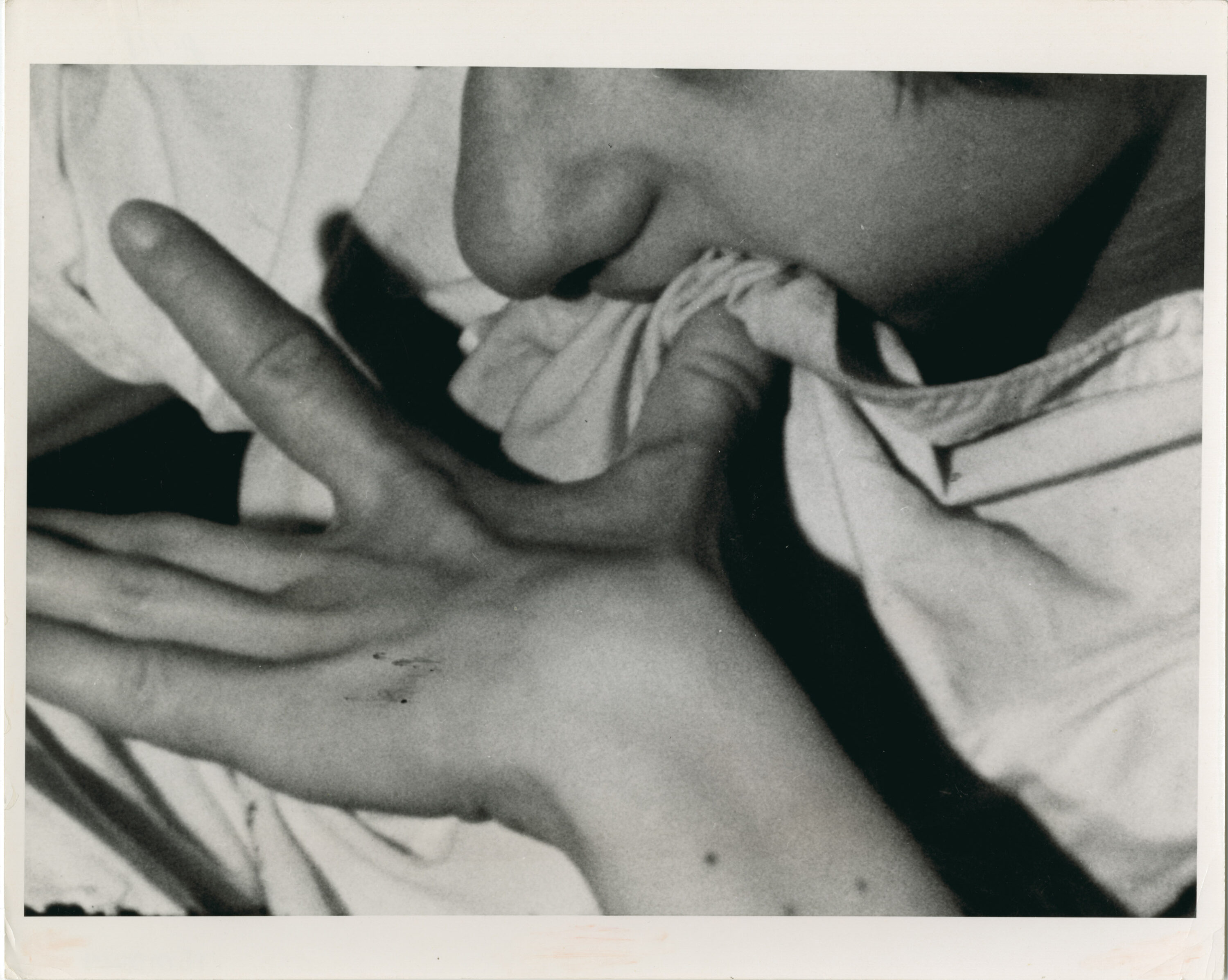 Patient at Willowbrook State School